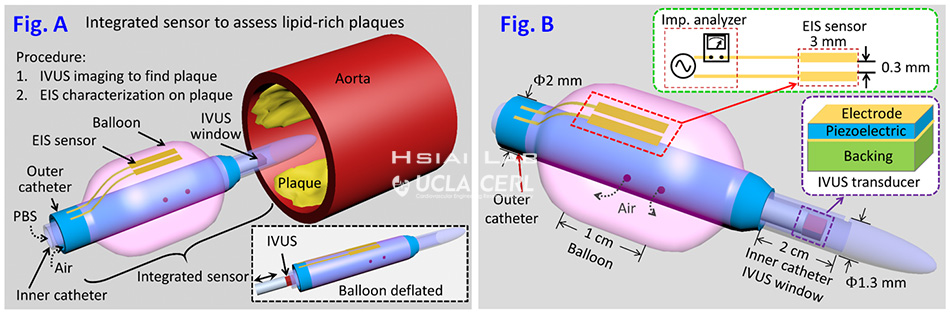 Intravascular deployment of the integrated EIS sensor
And IVUS transducer to assess lipid-laden plaques, Tzung Hsiai Lab